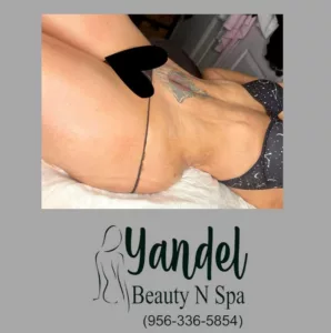Post Surgery Massages by Yandel Beauty Spa